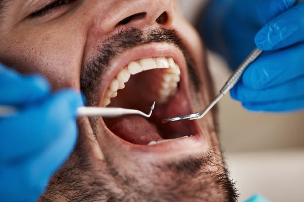 Best Broken or Cracked Tooth Emergency Dentist in Tacoma, WA